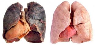 pulmóns do fumador e saudable